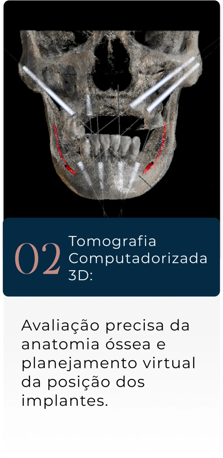 Group-1171275083-1.webp