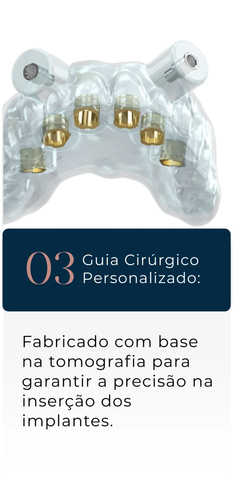 Group-1171275085.webp