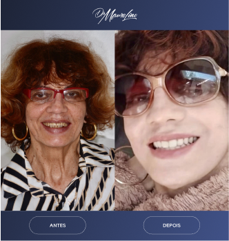antes-e-dpeois-03.webp
