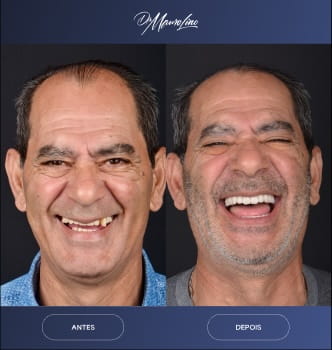 #image_title